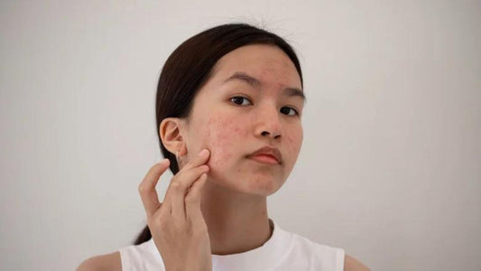 acne prevention  best skin care routine  exfoliate  hyperpigmentation  inflammation  menopausal skincare  moisture barrier  skincare routine  toner